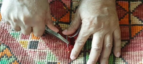 Turkish Rug Repair Encinitas